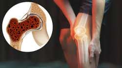 Best Bone Cancer  Treatment Hospitals in  Bangalore